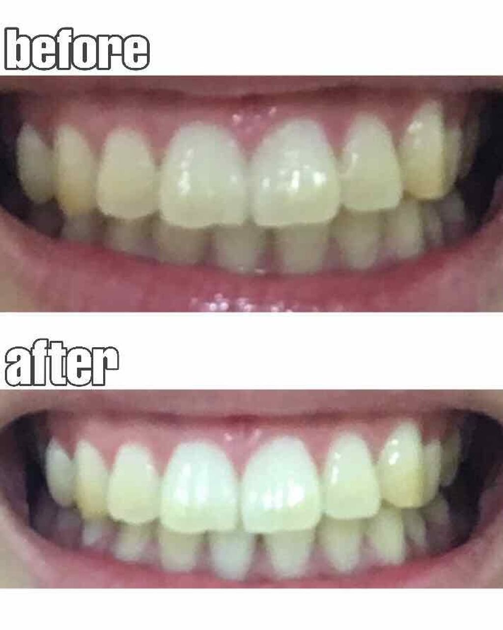 重曹つるつるハミガキ/毛穴撫子/歯磨き粉を使ったクチコミ(1枚目)