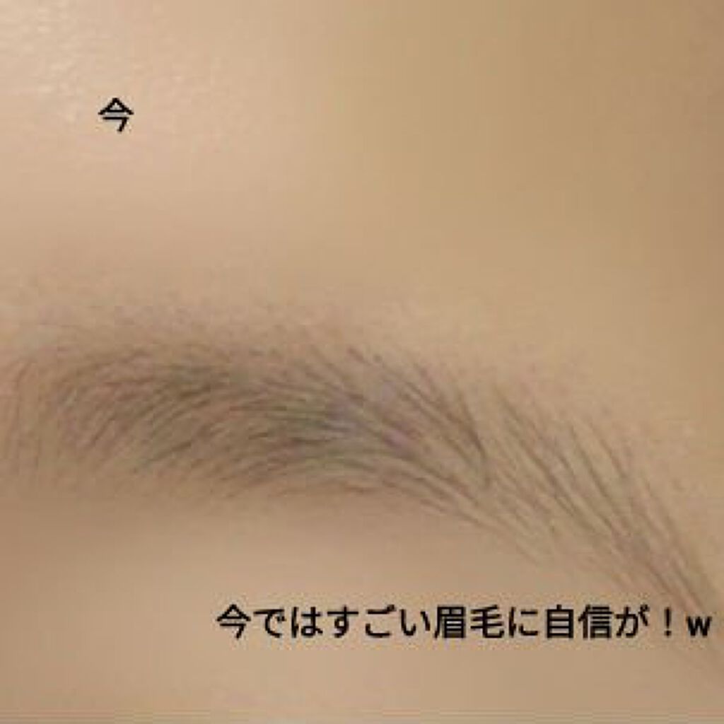 プリティー 敏感肌用フェイスL 3本入/貝印/シェーバーを使ったクチコミ（3枚目）