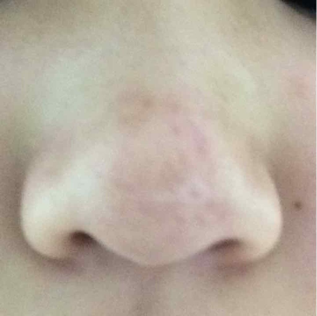 すっきり毛穴パック 黒/M's one/シートマスク・パックを使ったクチコミ(1枚目)