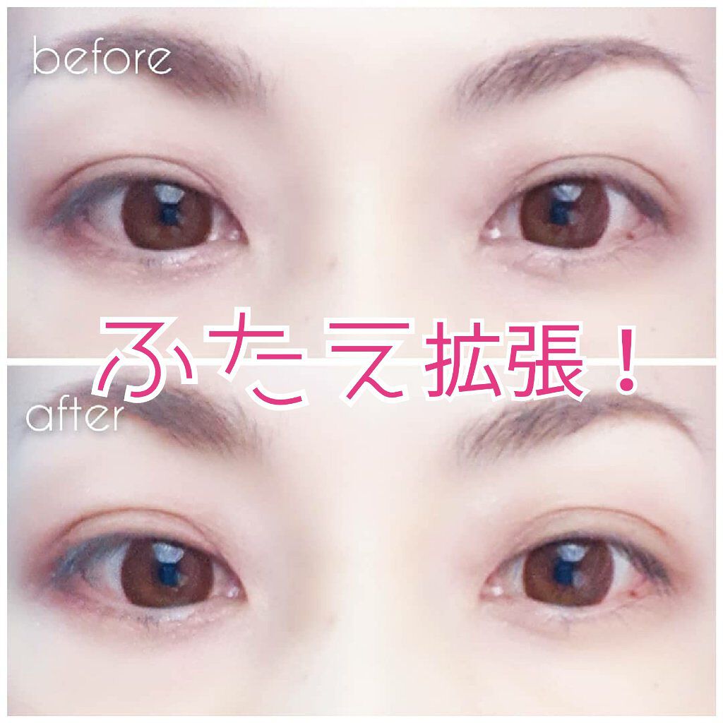 ふたえメッシュテープ/Eye Catching  Beauty/二重まぶた用アイテムを使ったクチコミ（1枚目）