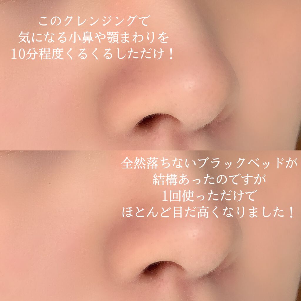 スパ・エ・メール ファンゴ シーバムクリア パック/Prédia/シートマスク・パックを使ったクチコミ(2枚目)