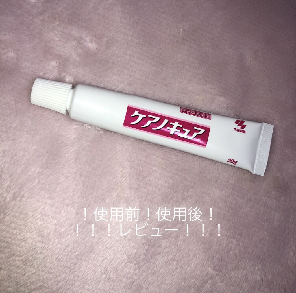 ケアノキュア（医薬品）/小林製薬/その他を使ったクチコミ（1枚目）