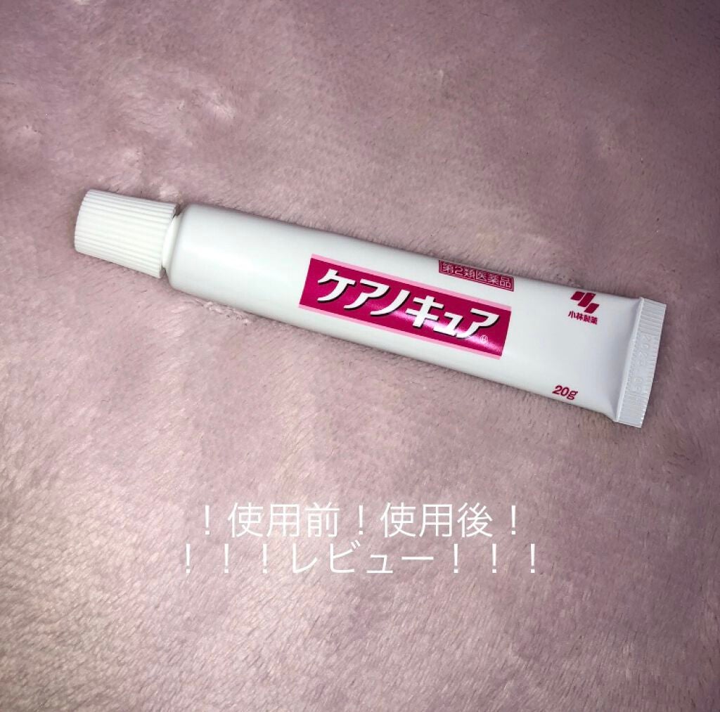 ケアノキュア(医薬品)/小林製薬/その他を使ったクチコミ(1枚目)