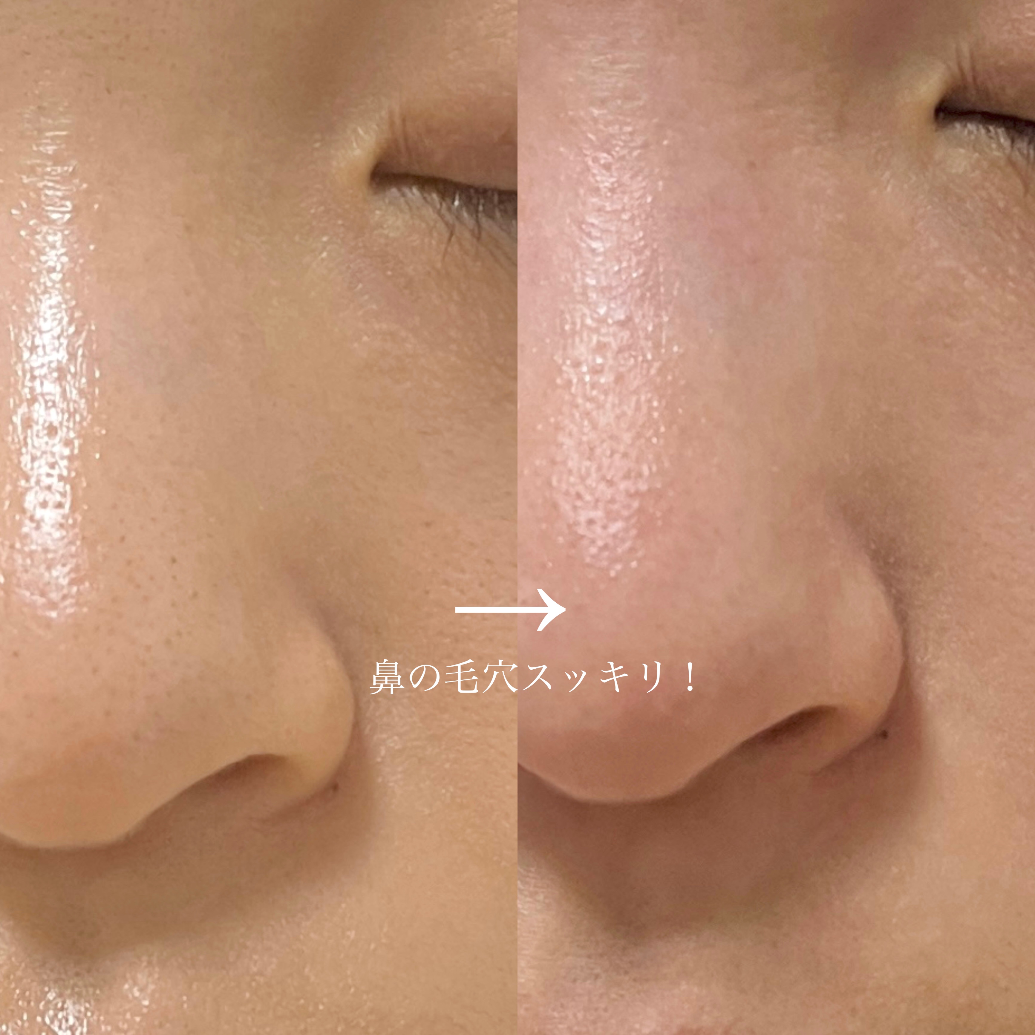 皮脂ごっそり毛穴パック/HANYUL(ハンユル)/洗い流すパック・マスクを使ったクチコミ（3枚目）