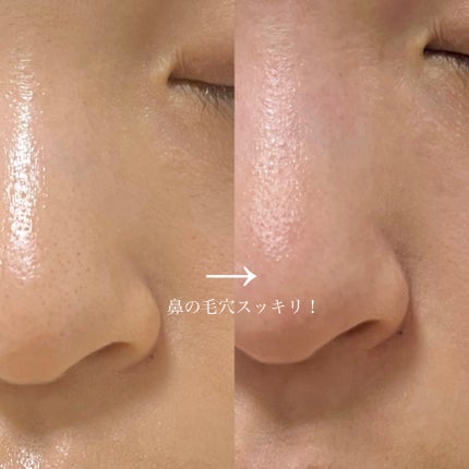 皮脂ごっそり毛穴パック/HANYUL(ハンユル)/洗い流すパック・マスクを使ったクチコミ(3枚目)