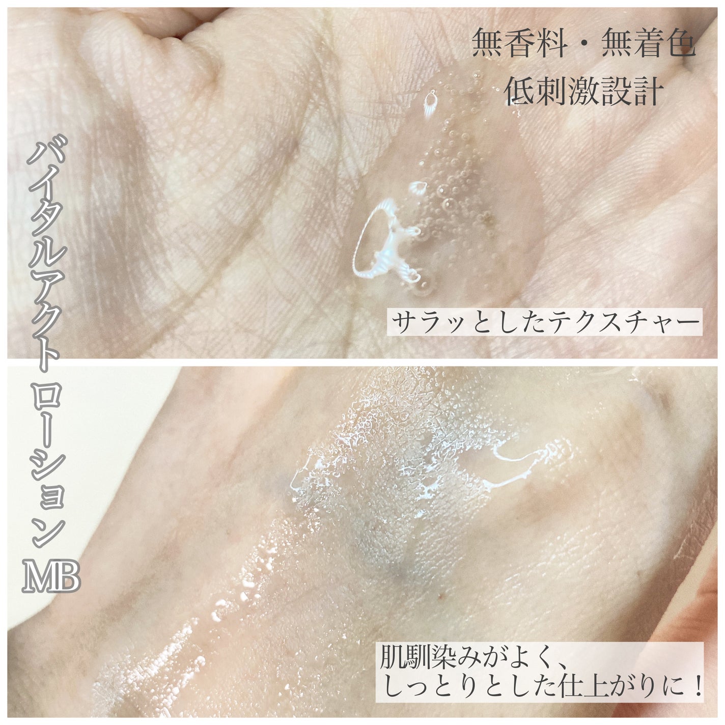 バイタルアクト ローション MB/d プログラム/化粧水を使ったクチコミ(2枚目)