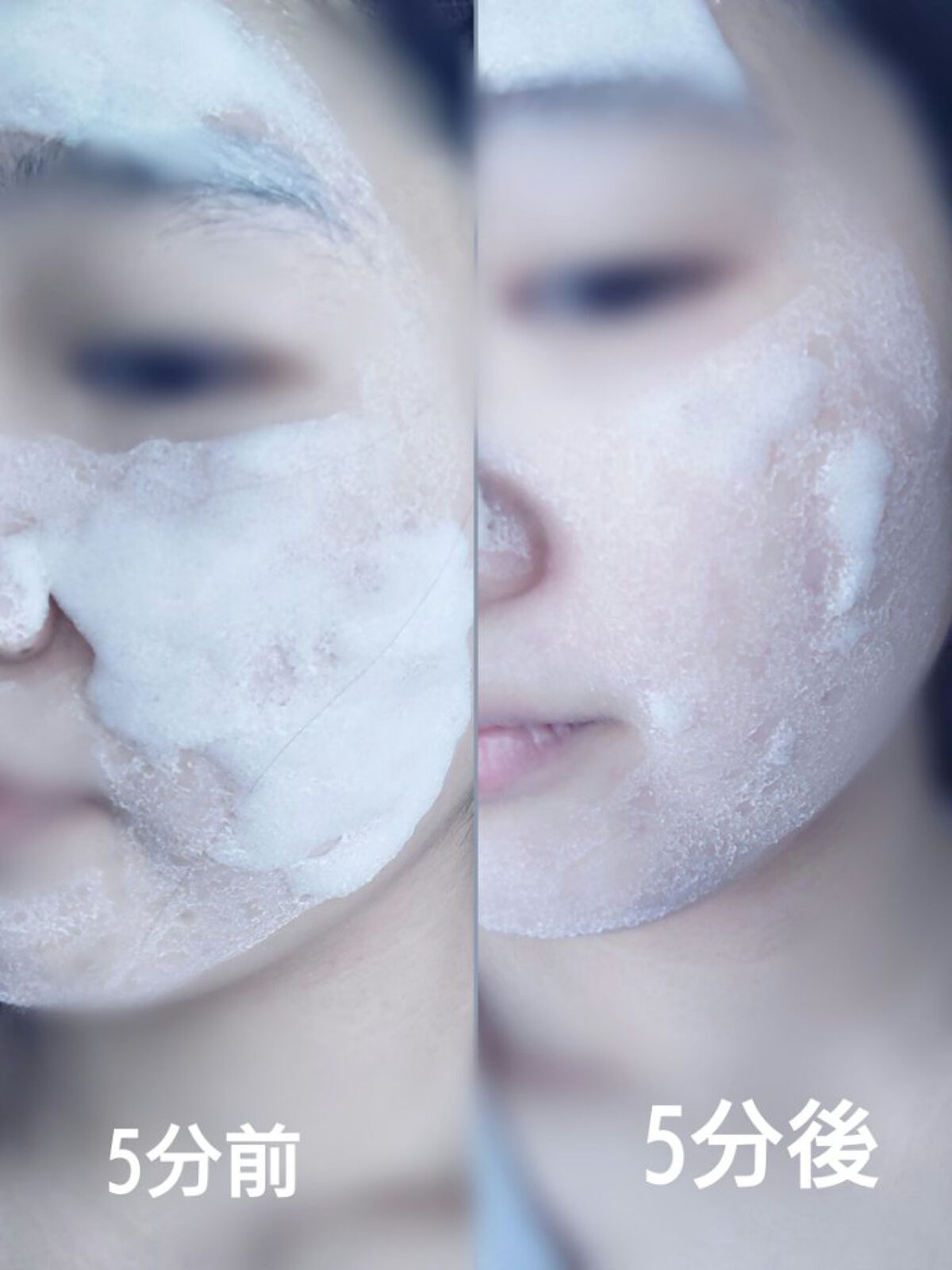 ももぷり フレッシュバブルパック/ももぷり/洗い流すパック・マスクを使ったクチコミ（3枚目）