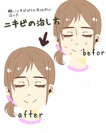 薬用 しみ 集中対策 美容液/メラノCC/美容液を使ったクチコミ(3枚目)