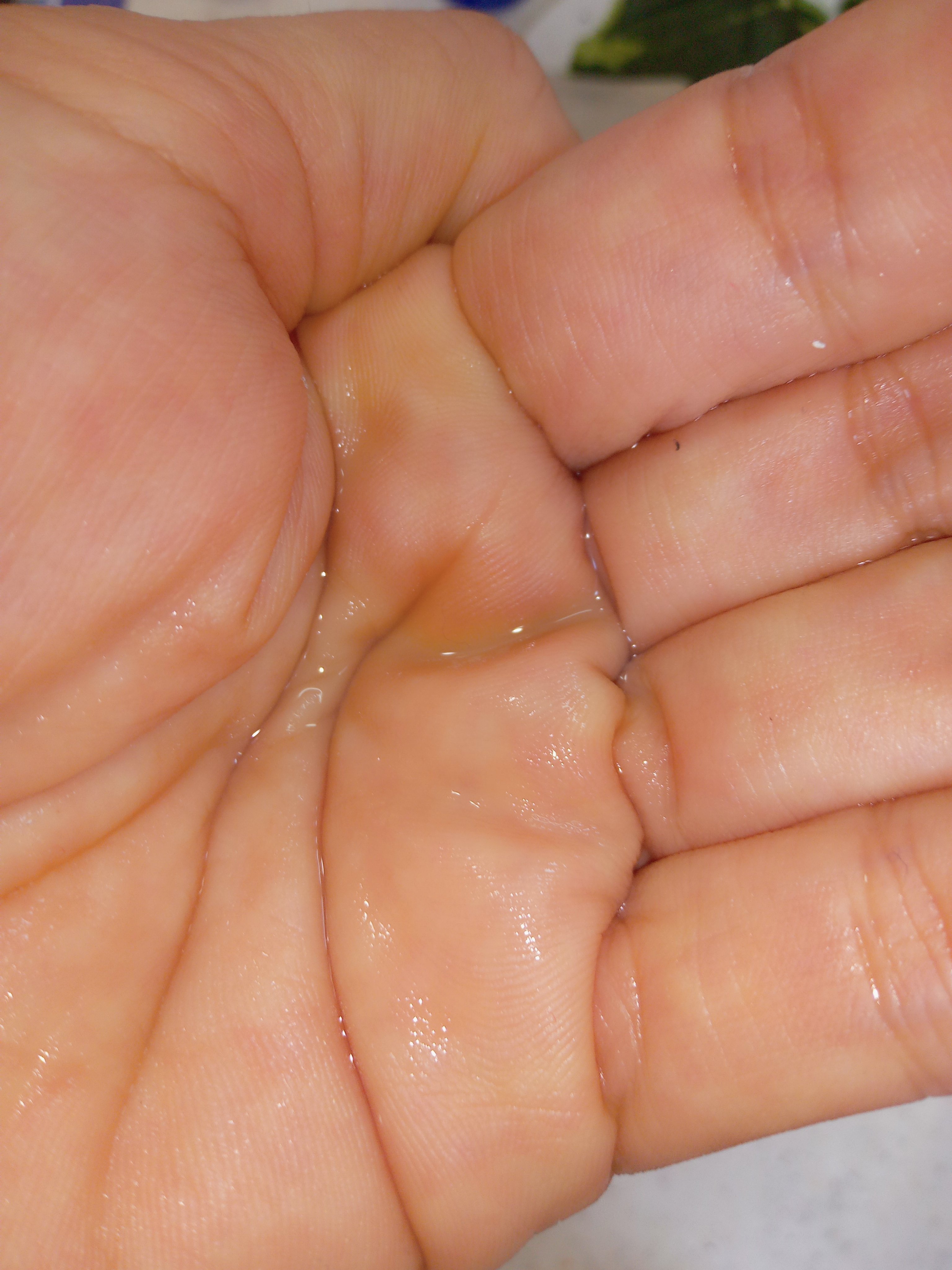 薬用 雪肌精/雪肌精/化粧水を使ったクチコミ（3枚目）