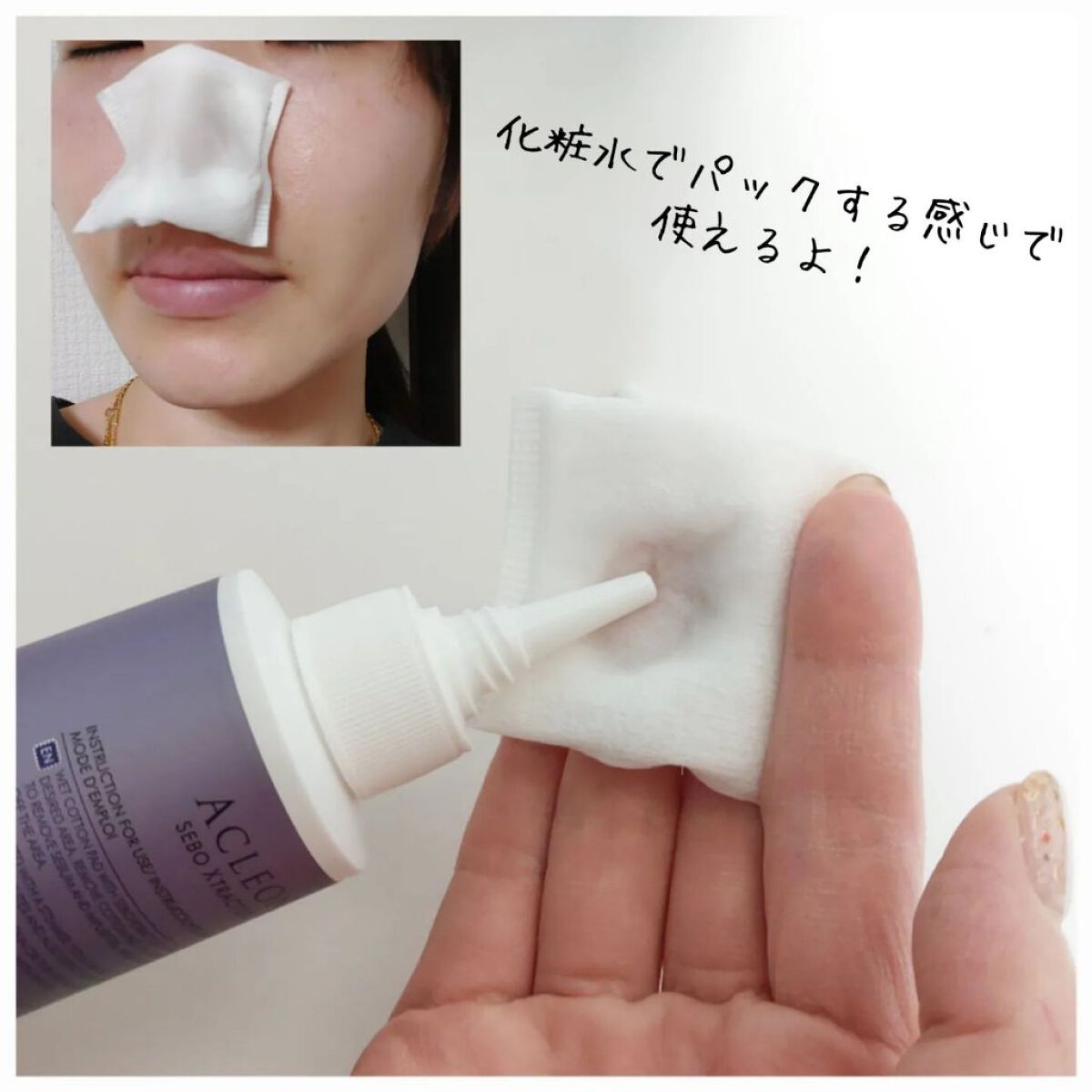 アクレオンセボエクストラクター/ANACIS/その他スキンケアを使ったクチコミ（3枚目）