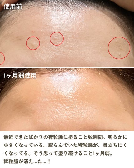 オーガニック ハトムギエキス (ヨクイニン)/KISO/その他を使ったクチコミ(4枚目)