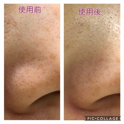 パーフェクトホワイトクレイ/SENKA(専科)/洗顔フォームを使ったクチコミ(3枚目)