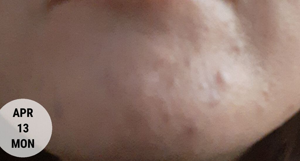 エリクシール ホワイト クリアエマルジョン C II/エリクシール/乳液を使ったクチコミ（2枚目）