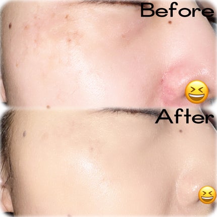 ダーマシンコンシーラー/23years old/リキッドコンシーラーを使ったクチコミ(3枚目)