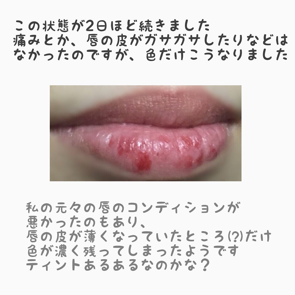 ケイト リップモンスター/KATE/口紅を使ったクチコミ(4枚目)