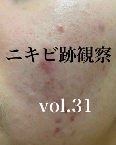 敏感肌用薬用美白美容液/無印良品/美容液を使ったクチコミ（1枚目）