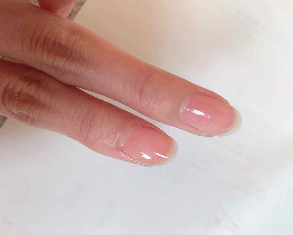 ネイルサポート ピンク/ネイルネイル/ネイルベースコートを使ったクチコミ(4枚目)