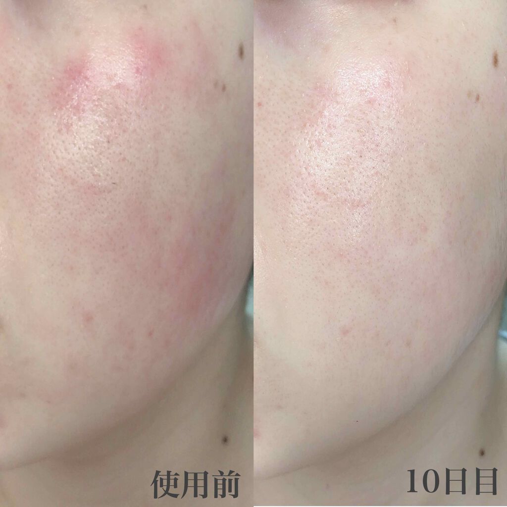 CICA クリーム/VT/フェイスクリームを使ったクチコミ(4枚目)