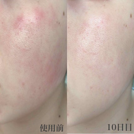 CICA クリーム/VT/フェイスクリームを使ったクチコミ(4枚目)