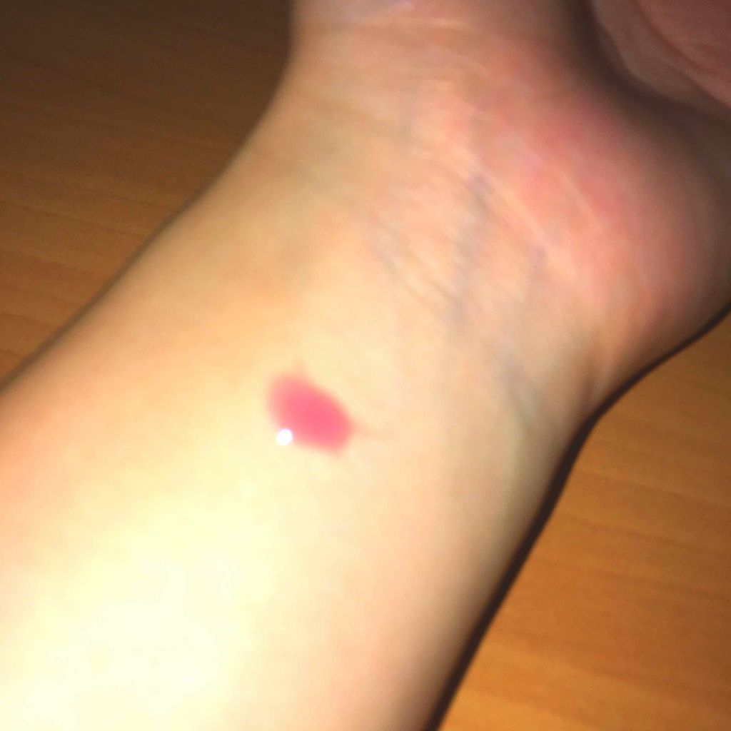 リップエッセンス/Angel Pure(エンジェルピュア)/リップケアを使ったクチコミ（2枚目）