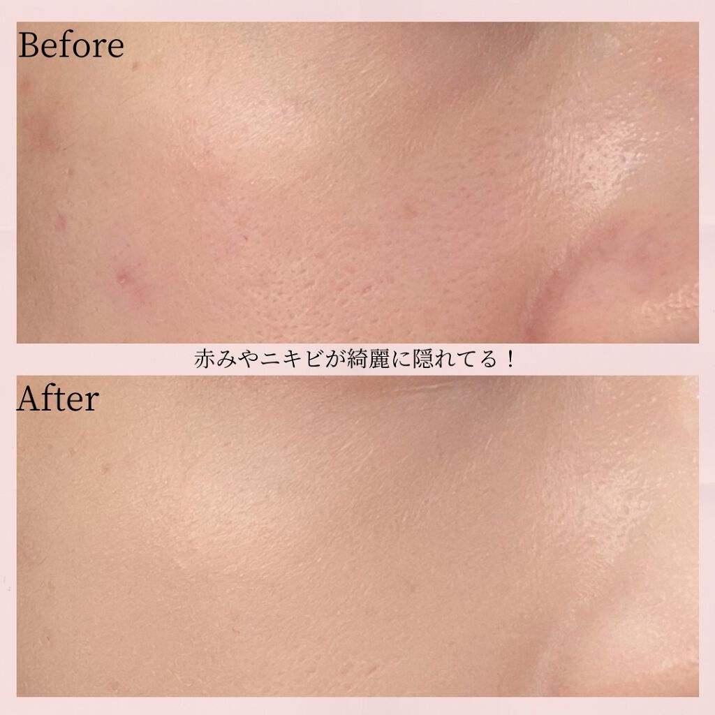 ピンクティーツリーカバークッション/APLIN/クッションファンデーションを使ったクチコミ(6枚目)