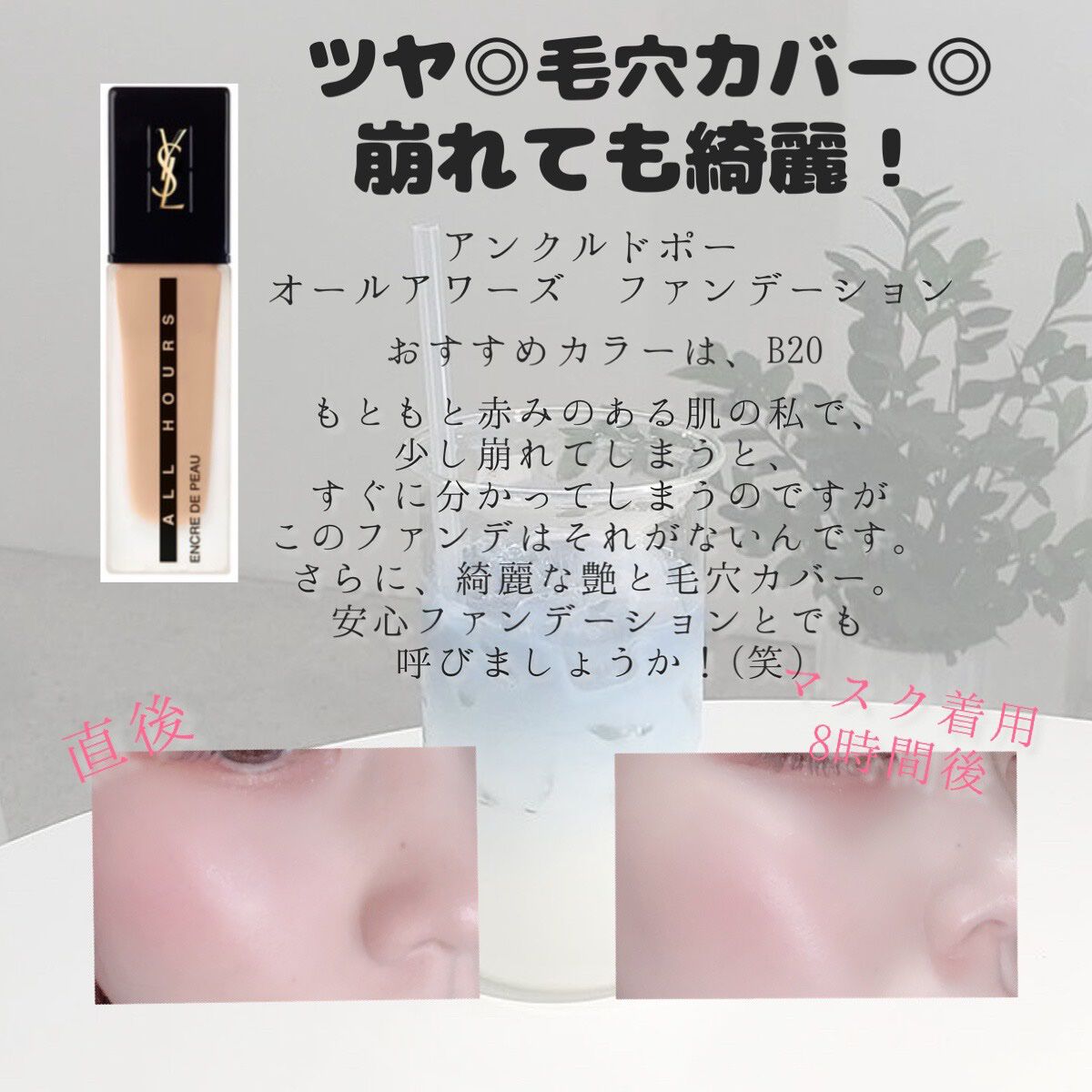 Yves Saint Laurent アンクルドポー