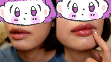 ドトムリッププラスプランパー/keybo/リッププランパーを使ったクチコミ(6枚目)