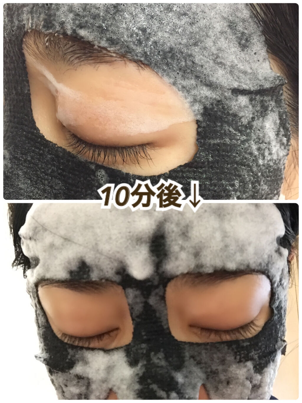 ブライトニング バブルトックス セラムマスク/MEDIHEAL/シートマスク・パックを使ったクチコミ（2枚目）