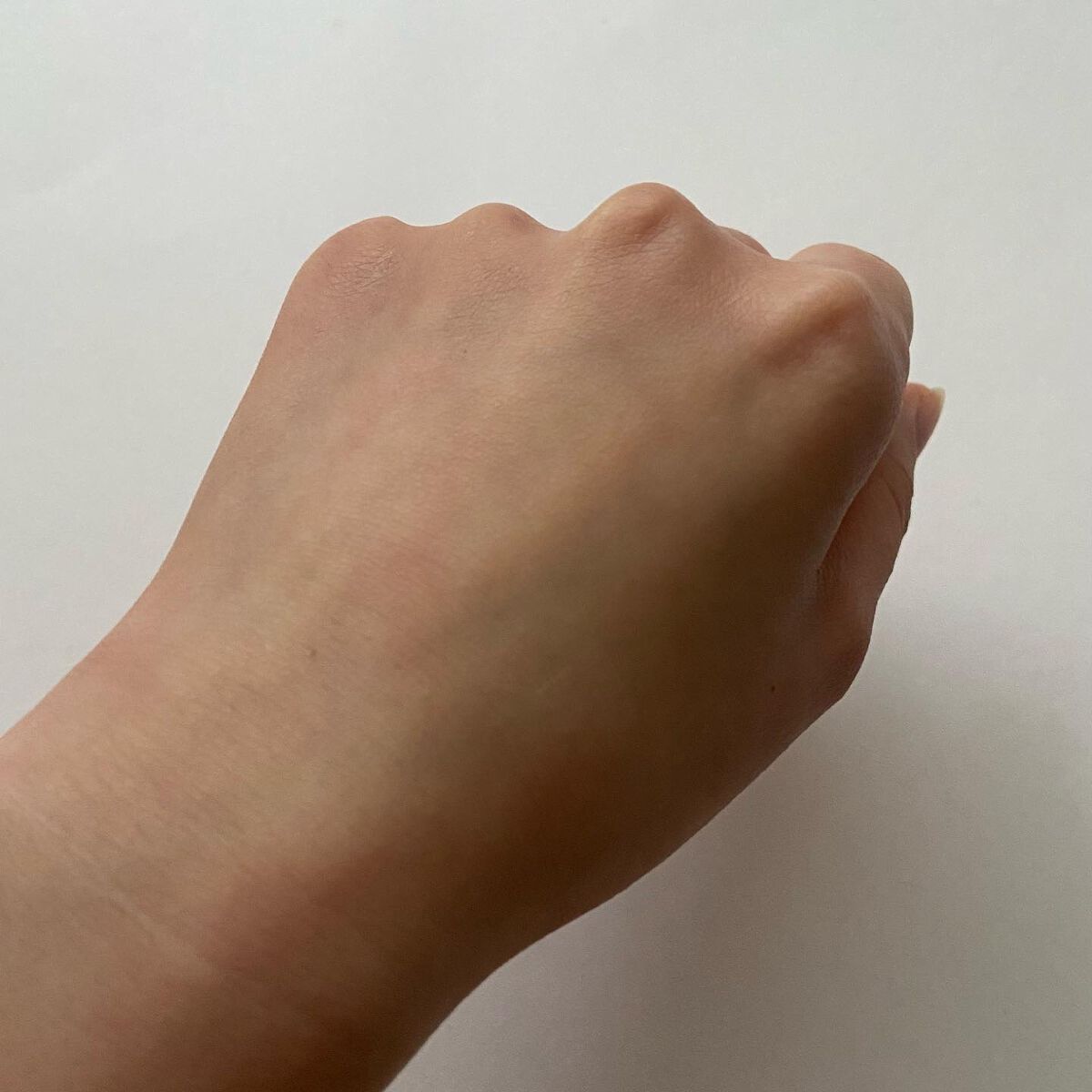 スージング アルニカクリーム/ARGITAL/フェイスクリームを使ったクチコミ(5枚目)