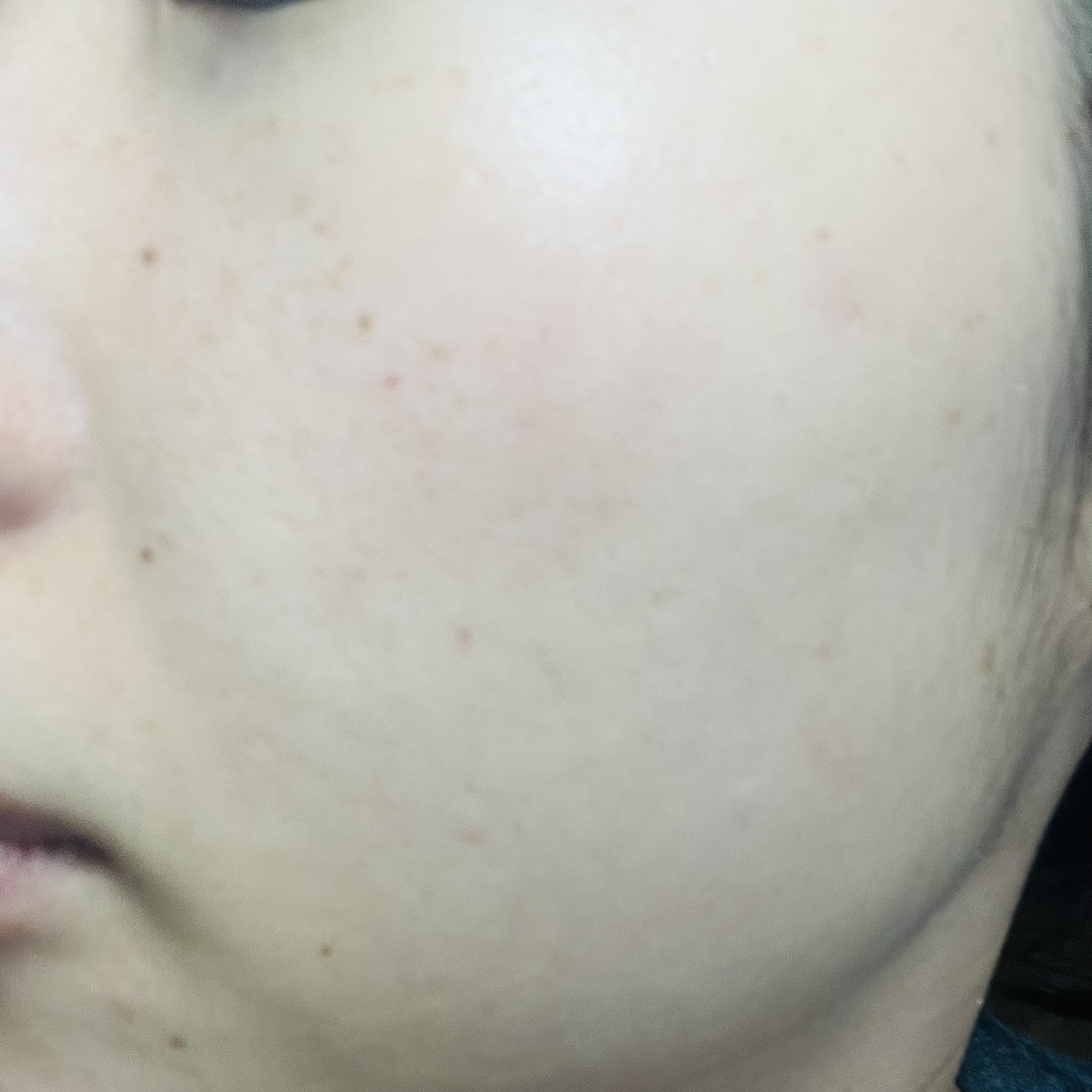 ジェニフィック アルティメ セラム/LANCOME/美容液を使ったクチコミ（3枚目）