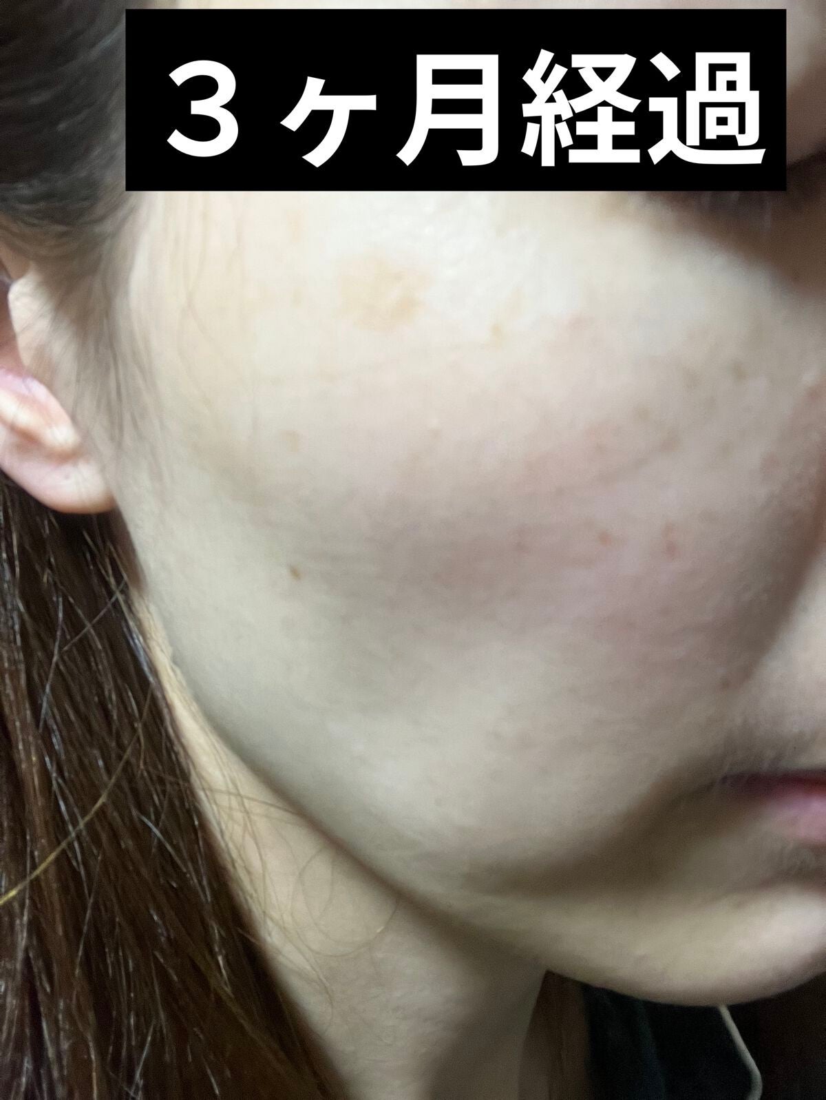 C25セラム ネオ/オバジ/美容液を使ったクチコミ(5枚目)