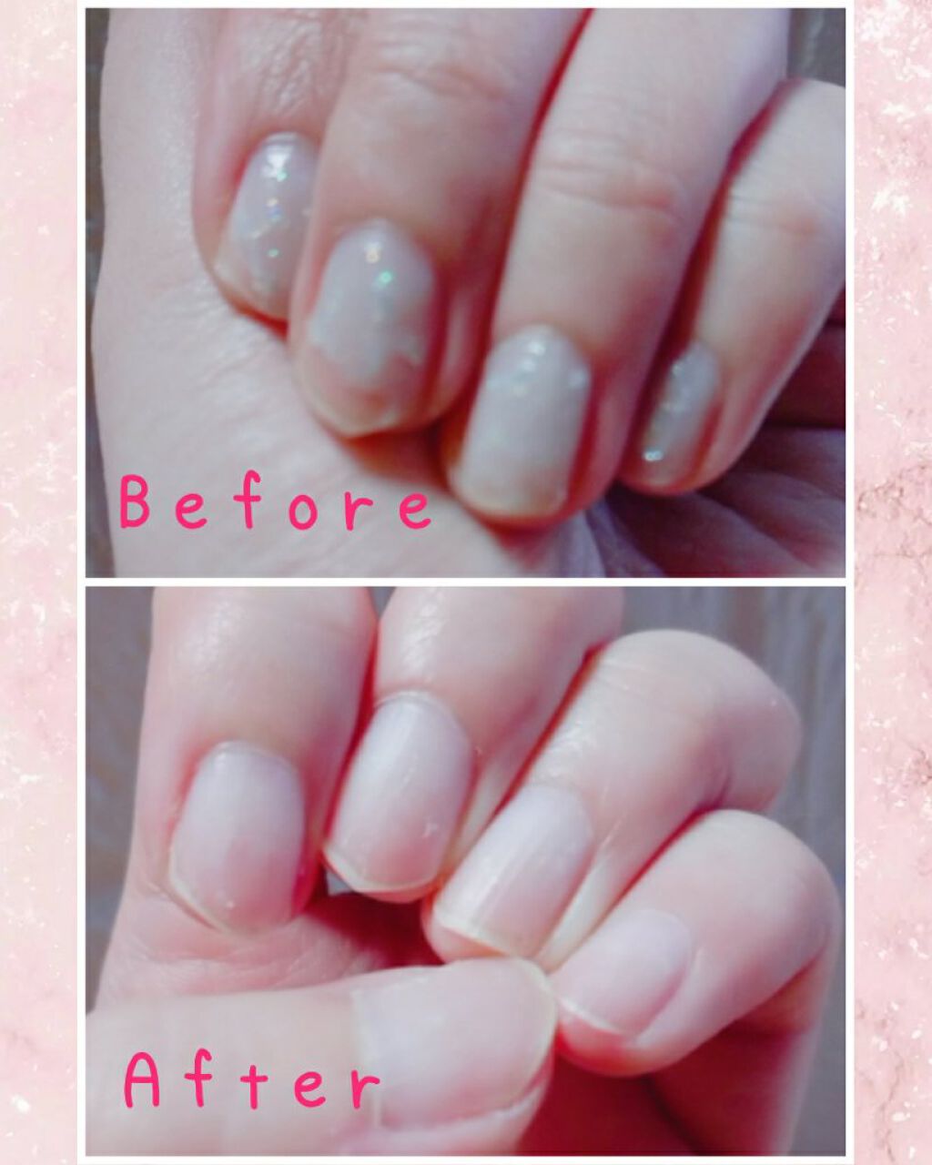 エルファー ネイルキッスC/DAISO/除光液を使ったクチコミ（3枚目）