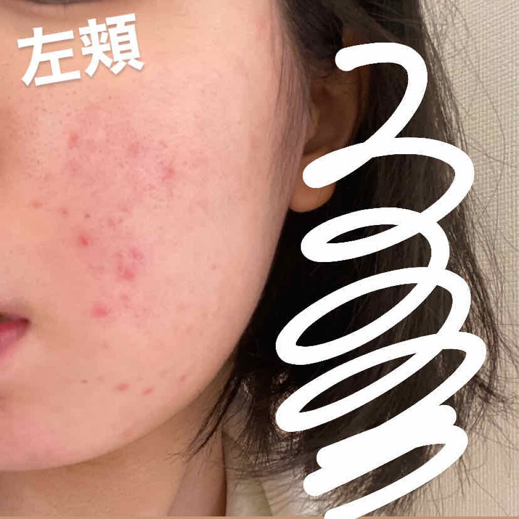 ハトムギ化粧水(ナチュリエ スキンコンディショナー R )/ナチュリエ/化粧水を使ったクチコミ（2枚目）