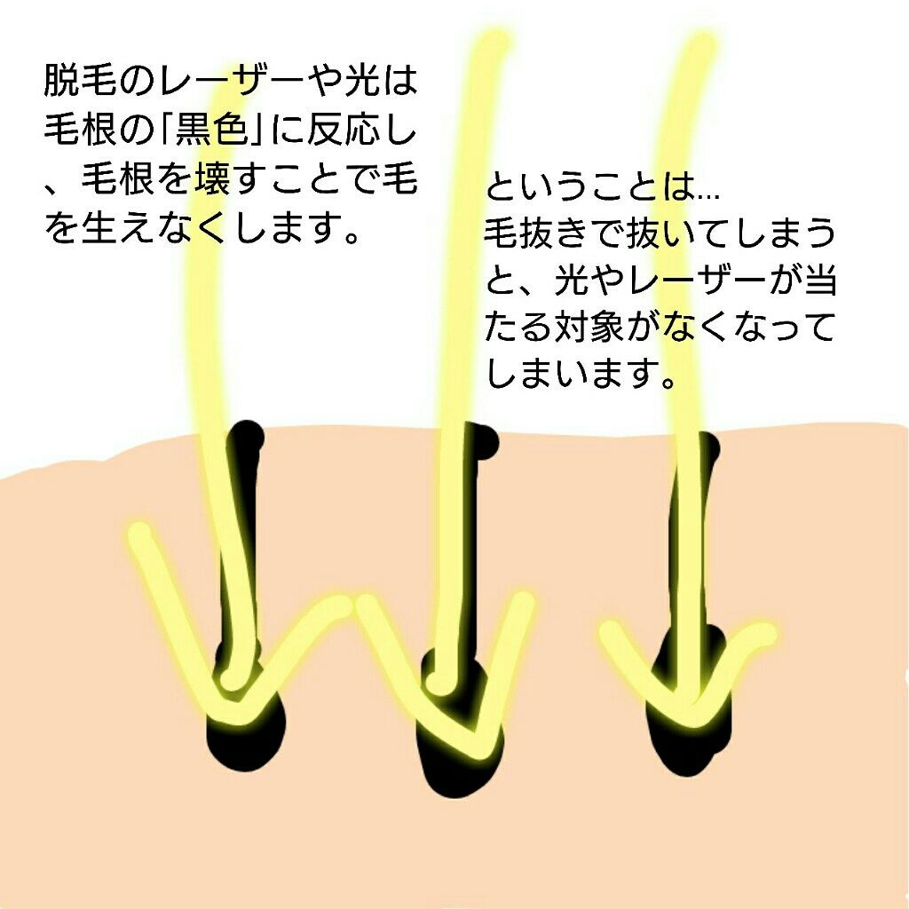 S.S.C. EPI PHOTO SKIN CARE PRO 家庭用光美容器 / ミュゼコスメの