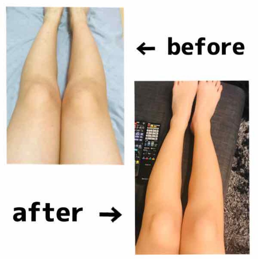 寝ながらメディキュット フルレッグ メディキュットの効果に関する口コミ 脚が太い でも着圧ソックスは高いし 本当に効果があるのか分からないと手が出せない By Riri Lips 寝ながらメディキュット フルレッグ メディキュットの効果に関する口コミ 脚が太い でも着圧ソックスは高いし 本当に効果があるのか分からないと手が出せない By Riri Lips