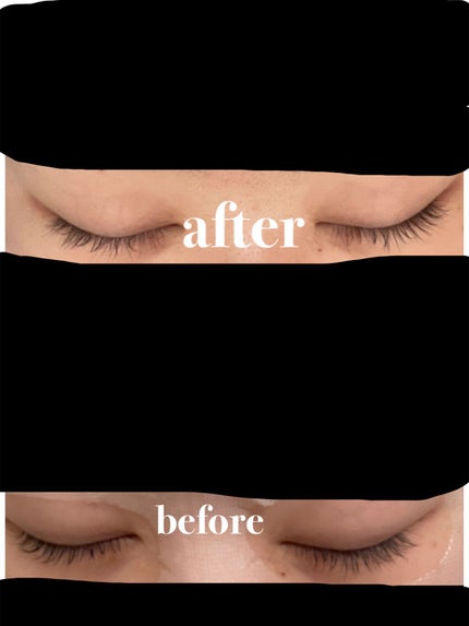 エグータム/アルマダスタイル/まつげ美容液を使ったクチコミ(1枚目)