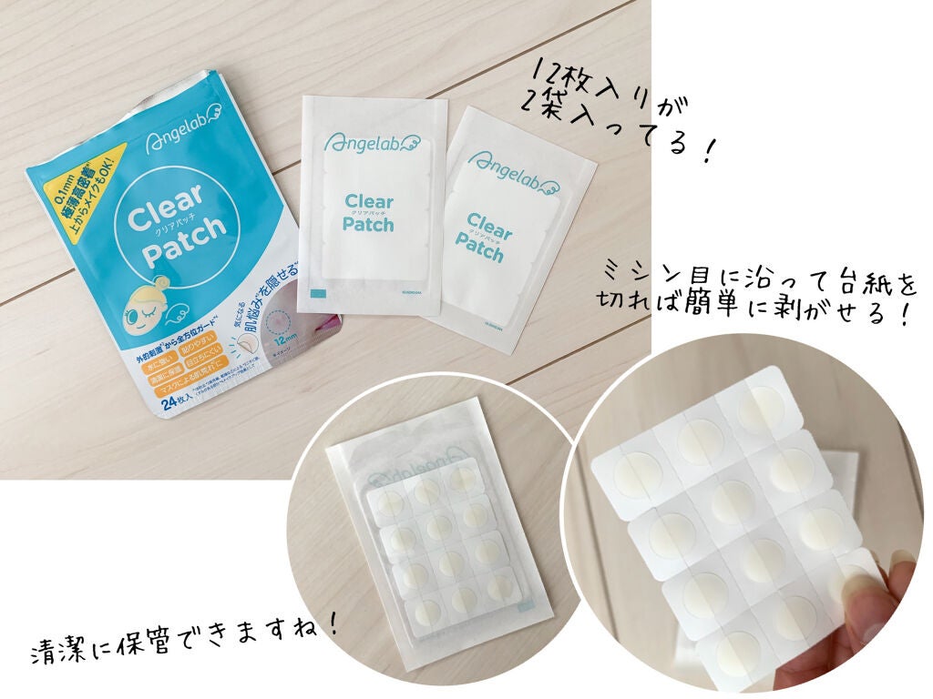 クリアパッチ/Angelab/にきびパッチを使ったクチコミ(3枚目)