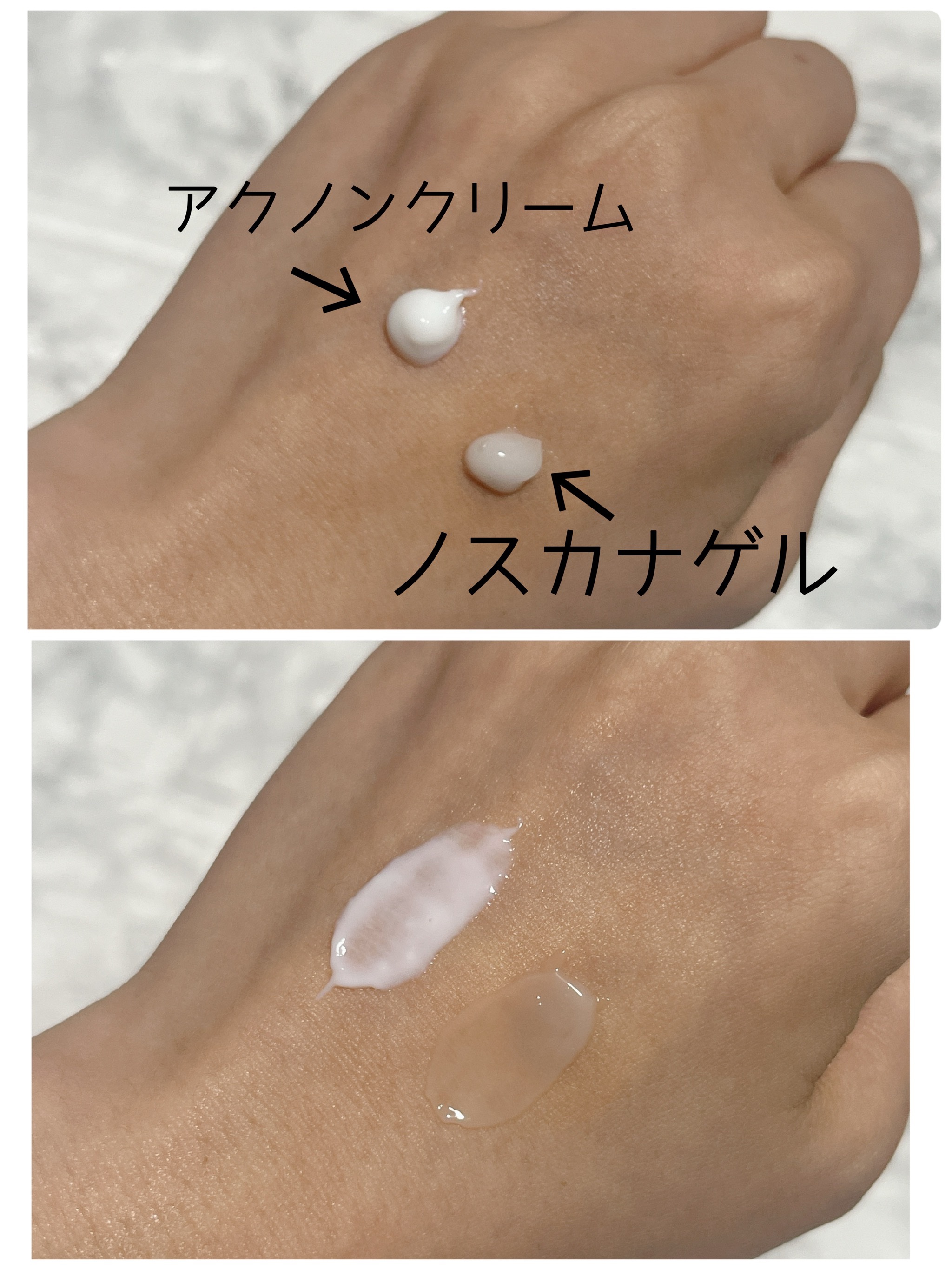 アクノンクリーム/東亜製薬/その他スキンケアを使ったクチコミ（2枚目）