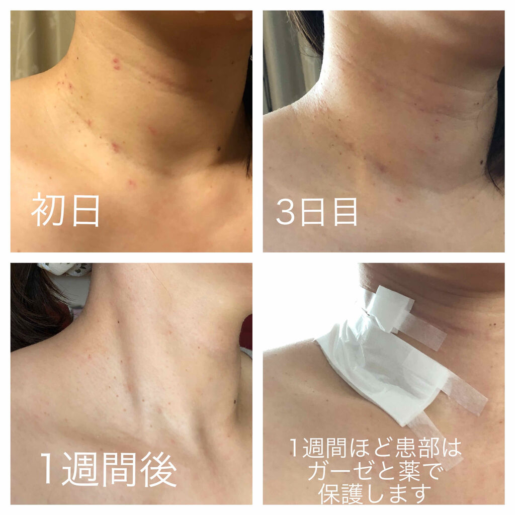 を使ったクチコミ（3枚目）