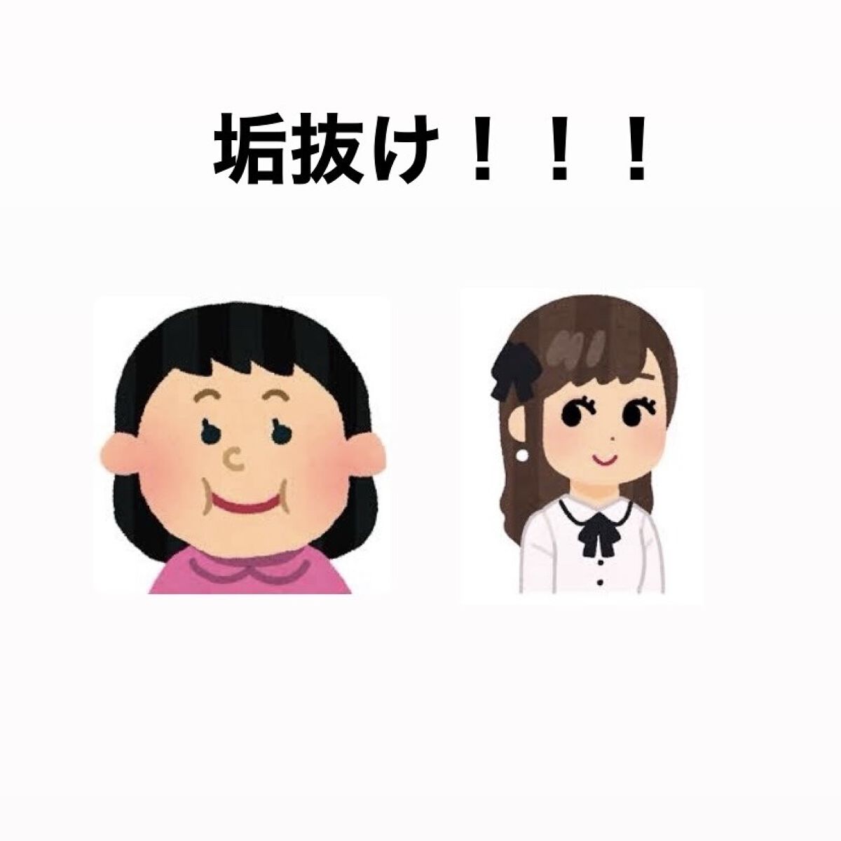 DHC ビタミンＣハードカプセル/DHC/美容サプリメントを使ったクチコミ（1枚目）