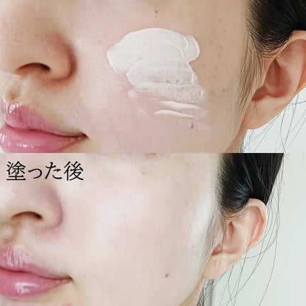 ブラックスネイルレチノールセラム/Dr.G/美容液を使ったクチコミ(5枚目)