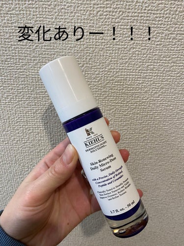 Kiehl's　DS RTN リニューイング セラム

今まで美容液でここまで劇的に変化を感じたのは初めてです！！

塗ってすぐピリピリして、
落とそうかと思ったけど我慢😇


1ヶ月近く使ってみた結果