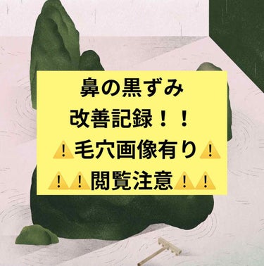 使用二日目
鼻の赤ニキビ＆毛穴詰まり悪化のため、皮膚科で処方されたデュアックという塗り薬を塗って2日目となりました。
2枚目今月上旬、3枚目今日です。
6年間、何をやっても消えなかった毛穴の黒いポツポツ