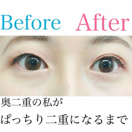 オリシキ アイリッドスキンフィルム /D-UP/二重まぶた用アイテムを使ったクチコミ(1枚目)