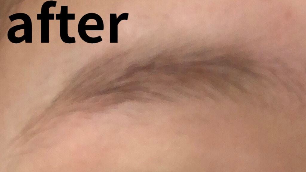 脱色クリーム 敏感肌用/エピラット/ムダ毛ケアを使ったクチコミ(5枚目)