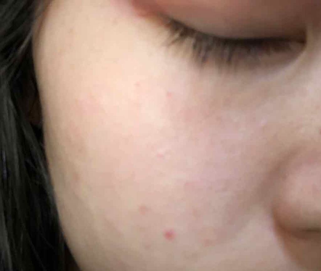 chi_sama_ð° on LIPS ã質åãªã®ã§ãããç®ã®äžã«å°ãããããããšããããããã®åãããŸ..ãïŒ2æç®ïŒ