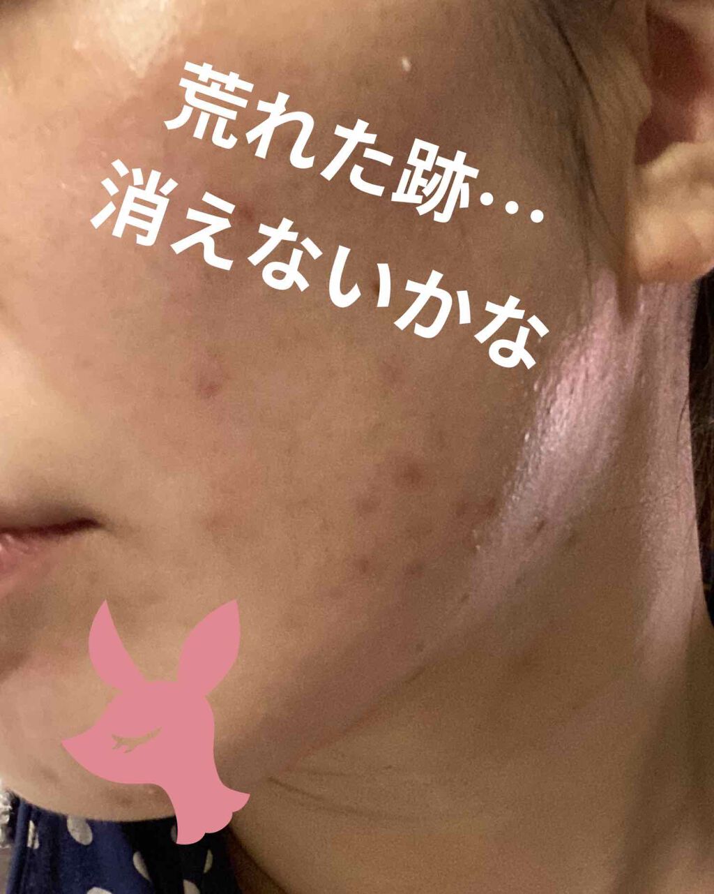 CICA スリーピングマスク/VT/シートマスク・パックを使ったクチコミ（2枚目）