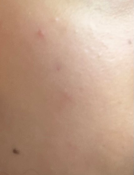 ハトムギ化粧水(ナチュリエ スキンコンディショナー R )/ナチュリエ/化粧水を使ったクチコミ(3枚目)