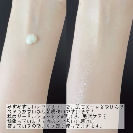 シカレチA エッセンス0.1/VT/美容液を使ったクチコミ(6枚目)