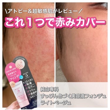 ⁡
純白専科
⁡
すっぴん色づく美容液フォンデュ
ライトベージュ
⁡
SPF30／PA＋＋＋
⁡
－－－－－－－－－－－－－－－－－－－－
⁡
⁡
産後肌質が変わって前使ってた下地が荒れるようになったの